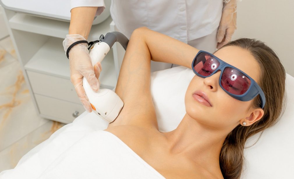 Laser hair removal