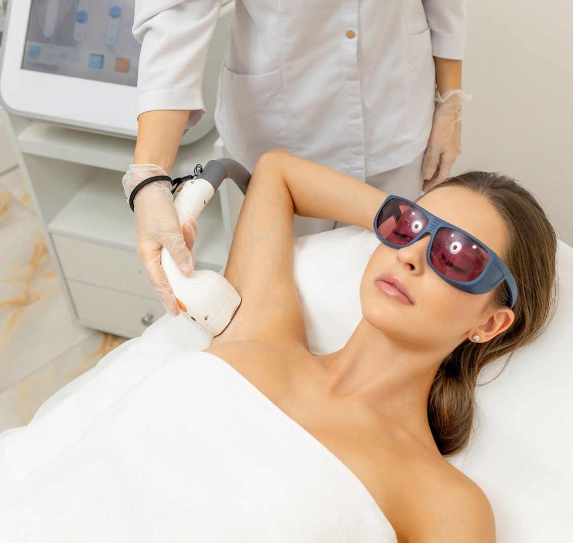 Laser hair removal