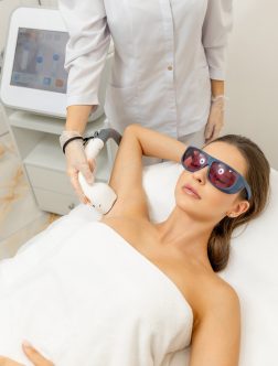 Laser hair removal