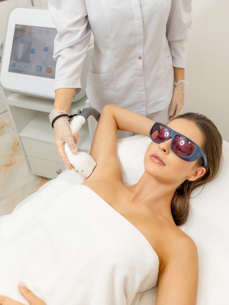 Laser hair removal