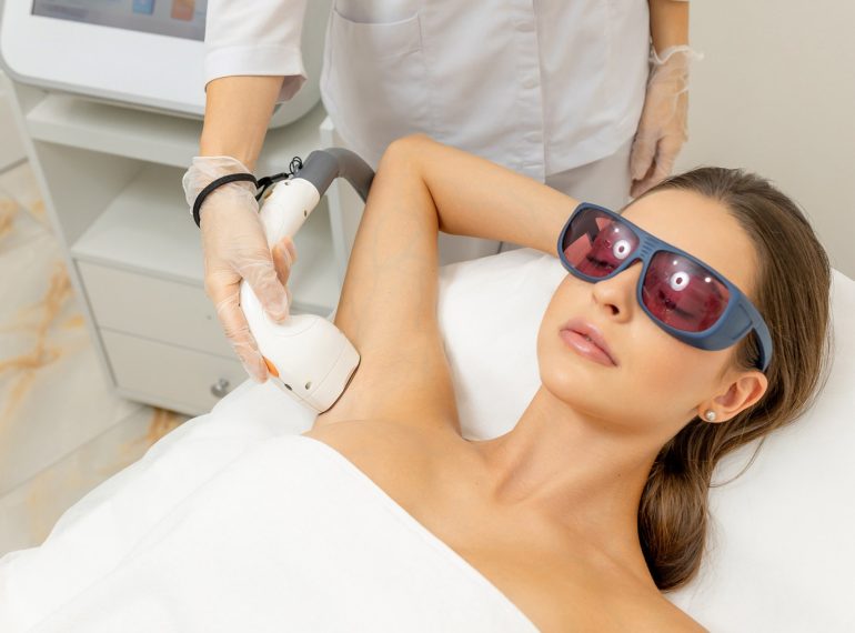 Laser hair removal
