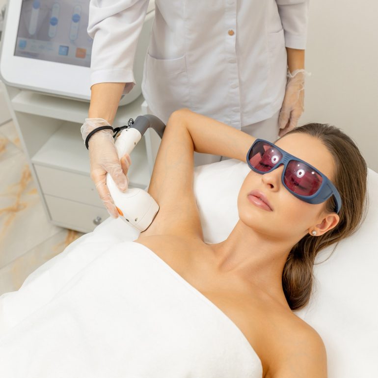 Laser hair removal